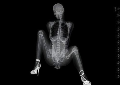 metaconscious:  Eizo, a manufacturer of medical imaging equipment, has released a revealing new calendar to promote their wares.  The Eizo X-Ray Pin-Up Calendar is at once hilarious and inventive, a most creative way of promoting their brand to their
