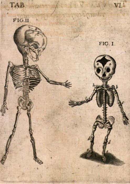 †