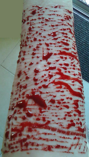 mordelialestrange:  (My left arm; September 26th 2011) 