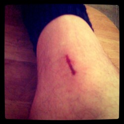 Trailer hitch went right into my leg after work tonight. In a wee bit of pain.  (Taken with instagram)
