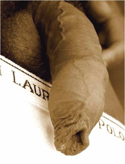 celebratingforeskin:  gio-graphic:  Perfect foreskin.  A fine example of Acroposthion (foreskin over