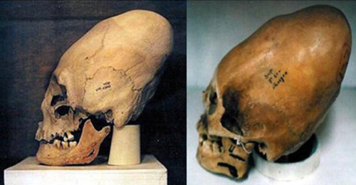 i-want-tobelieve: Peruvian SkullsThese odd elongated skulls originate from Peru. They were excavated