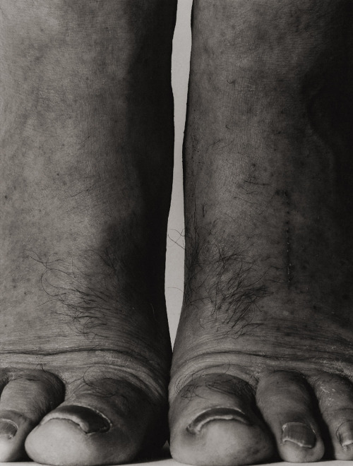 Self-Portrait: Feet Frontal  by John Coplans, 1984