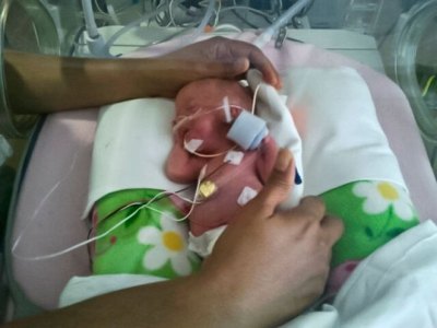 thedailyfeed:
“ Meet the two-pound, 1-ounce Dottie Mae. She’s a gift. But she was given a very beautiful gift, too.
Her cancer-stricken mother, Stacie Crimm, 41, sacrificed her own life so that Dottie could be born.
“ Five months pregnant with her...