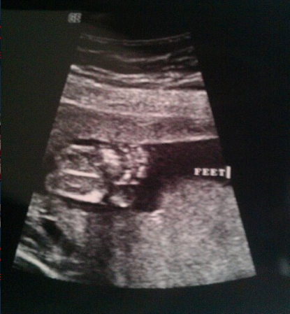 My baby’s feet at about 18 weeks. Beautiful :-)