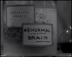   Dwight Frye uses bad judgement…………….Frankenstein (1931)    Abbey normal