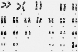 medicalschool:  Human Karyotype  I miss this shit! 