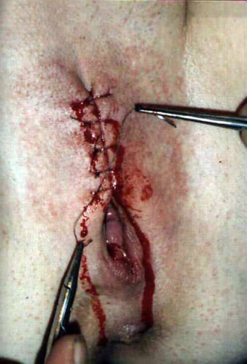https://extreme-bondage.tumblr.com/post/112196934152