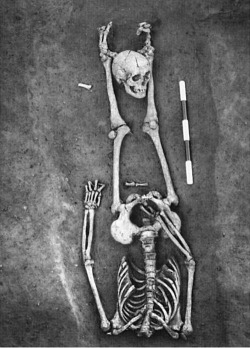 alphacaeli:  alphacaeli: A decapitated burial dating to the late fourth century AD from a cemetery excavated at Stanwick, England. (In Mays, S. [2010] The Archaeology of Human Bones, p. 250)  