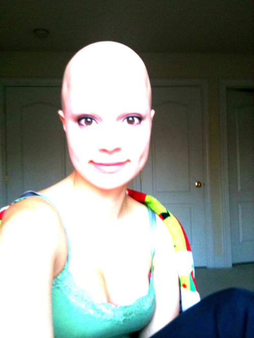 w-h-o-r-e-g-a-s-m:  this girl has alopecia. it’s a condition where your hair falls out for no reason. there’s no cure, & there’s no way of knowing if it will ever grow back. some people have success, while others stay bald. this girl has alopecia