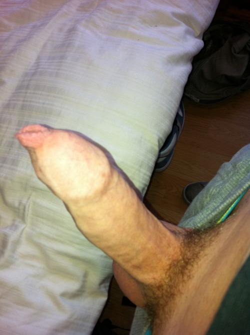4skindelight:  now that is gorgeous! gheylolz:  im-uncut:  damn look at all that foreskin, just dyin