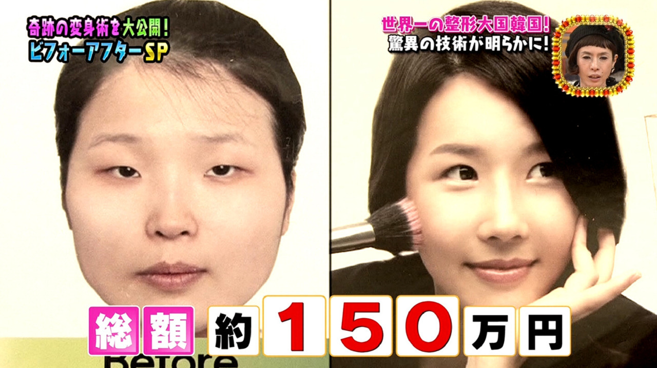 Overdope 美男美女 できた子供は ブ男ブ女 Overdope 美男美女 できた子供は ブ男ブ女
