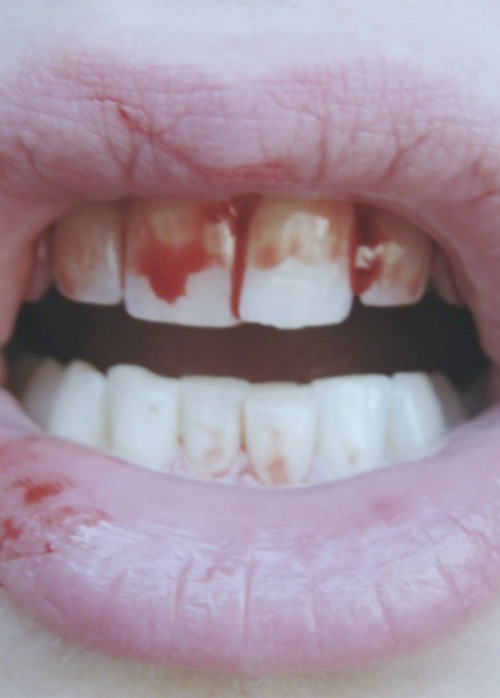 wretched-youth:  ♡ Grunge Blog ♡ 