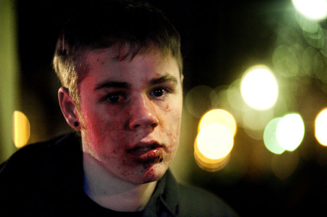 occupyonline:
“ December 3, 2011 — Walker Prettyman, 15, was injured during the Occupy Portland protest in Shemanski Park. According to Prettyman, a police officer hit him in the face with his riot stick.
”