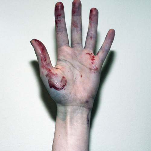 Are your hands so clean ?