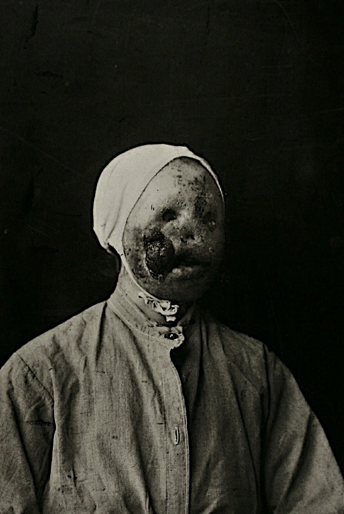 thetemperamentalgoat:   Utrecht goitre (Utrechtse Krop) is the title of a collection