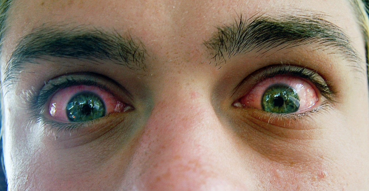 какие глаза после наркотика