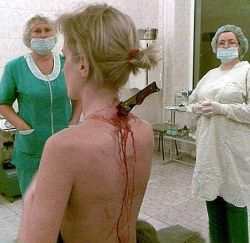 odditiesunsolved:  An extraordinary picture that has gone around the world of a knife plunged into the back of a woman mugging victim is genuine, it was revealed by doctors in Moscow. Julia Popova, 22, was stabbed by a mugger as she walked home from work