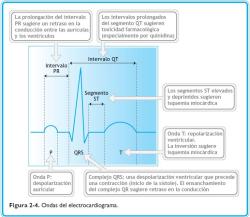 dratramadol:  Ondas del electrocardiograma.