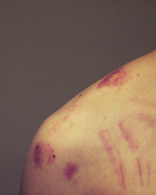 donvejar: Hickey man