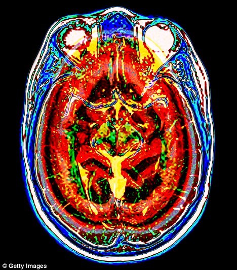 “Crucial Advances in ‘Brain Reading’ Demonstrated”
“ At UCLA’s Laboratory of Integrative Neuroimaging Technology, researchers use functional MRI brain scans to observe brain signal changes that take place during mental activity. They then employ...