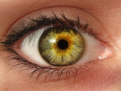 writeroost:  funwithmedicine:  Central heterochromia is