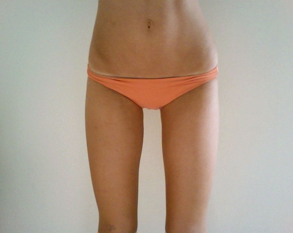 saola:  wild-l-o-v-e:  why can’t i be that skinnyyy  dedicate yourself and you