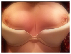 pantsinmypussy:  Beautiful titties, my nipples