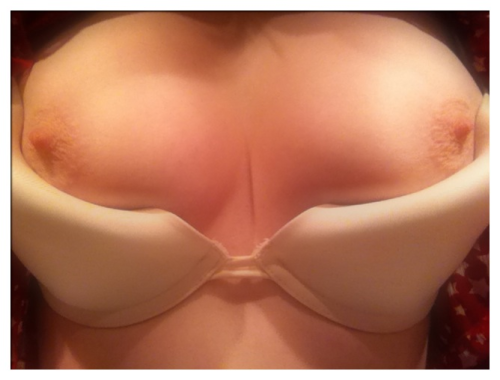 pantsinmypussy:  Beautiful titties, my nipples are ready to be sucked…come play sexies ;) 
