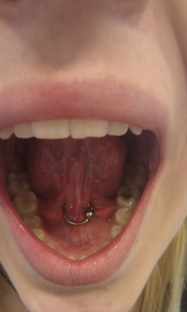 redinctattoo:
“ tongue web piercing by Grace @ RedINC
”