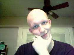 liquid-liam:  aquat1c:  i felt like showing you all my eye colour.   so this guy is pretty amazing to be honest, he suffers from a disease called Alopecia, meaning he can’t grow hair anywhere on his body, and among a generation of people who complain