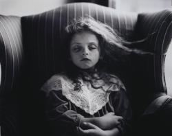 Sally Mann, Black Eye 1991