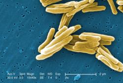 Mycobacterium tuberculosis. This bacteria is the main cause of TB in the world, it is stimated that one third of the worlds population is infected with this bacteria. It gets in your organism specifically inside of mononuclear cells (those cells are the