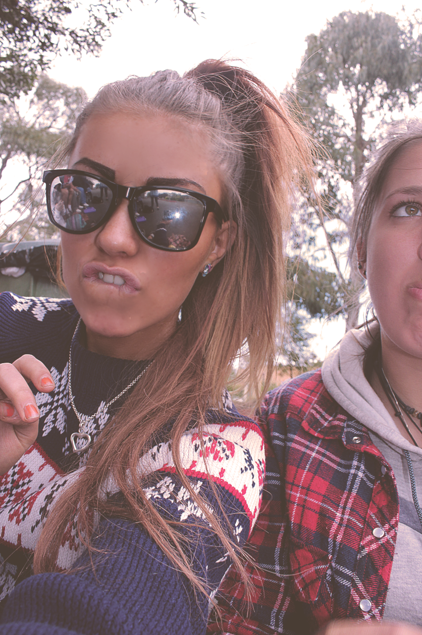 pea-ches:  here have my retarded facial expression and weird skin  