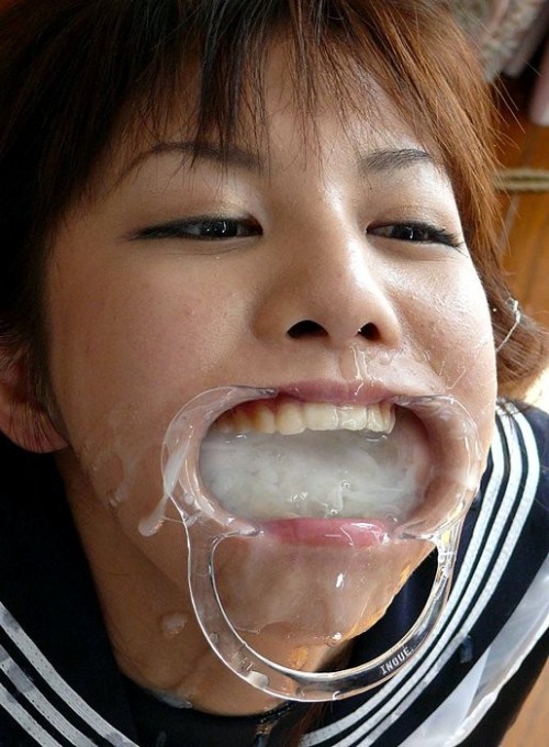 tapedlipsandglue: I love those mouth spreaders, Porn Photo Pics