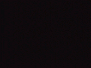 chicka-chicka-gifs:I can stand the sight of worms and look at microscopic germs but technicolor pach