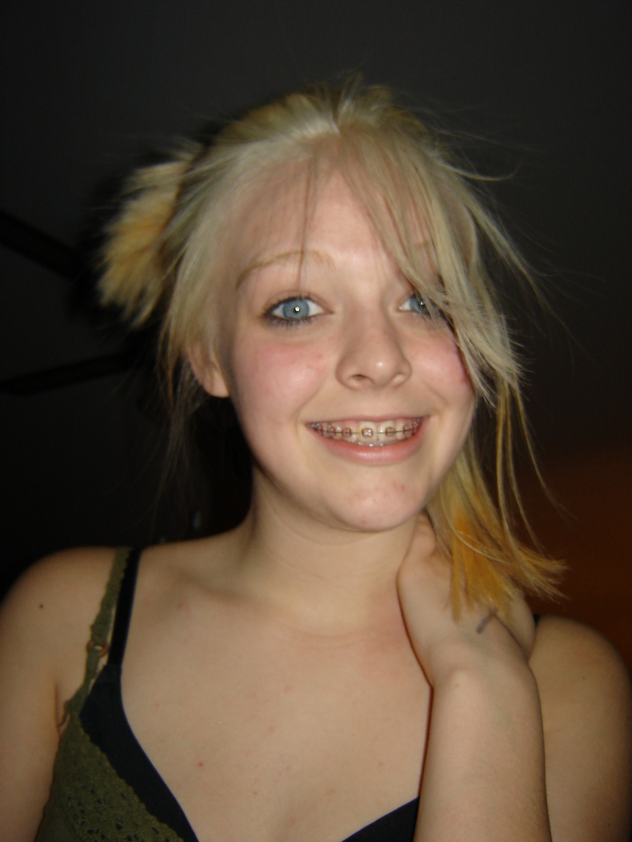 stillsomethingaboutbraces:  Thanks to allmyxxxs for the submission! Visit Something