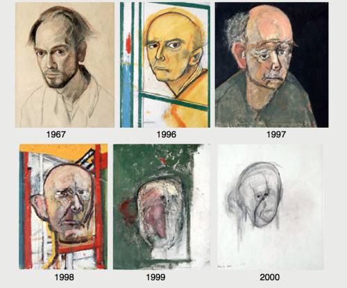  Self Portraits of a Declining Brain William Utermohlen is latest artist to be honored at the GV Art Gallery in London, with an event that has an emotional purpose that is near and dear to the hearts of many. Utermohlen spent the last twelve years of