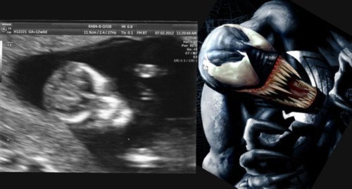 Man finds out his wife is pregnant with baby Venom. What do?
Via