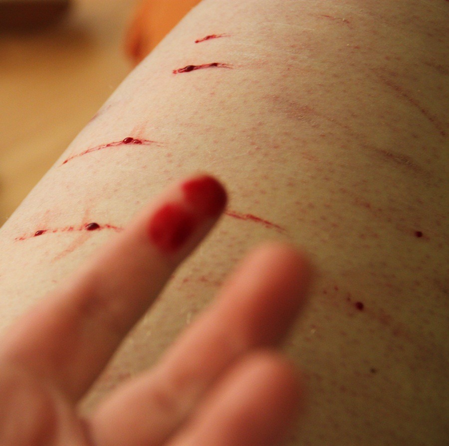 hello insanity