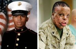 soflymetothemoon:  lovelivelifethenimdead:  blackgoddess:  afistfulloftalent:  thelcpljo:  leathernecklove:  Sgt. Merlin German The ‘Miracle’ Marine November 15th 1985- April 11th 2008 Merlin German waged that battle in the quiet of a Texas hospital,