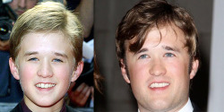 coelasquid:  Haley Joel Osment looks kind of like his head grew up but his face didn’t. 