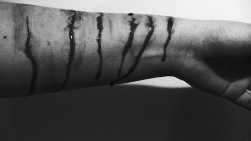 confissoesdeumasuicida:  E as cicatrizes,eu vou levar pro resto da minha vida. (cdus) 