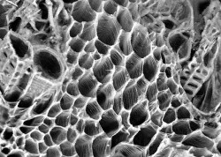 micro-scopic:  Aloe vera vascular bundle, Scanning