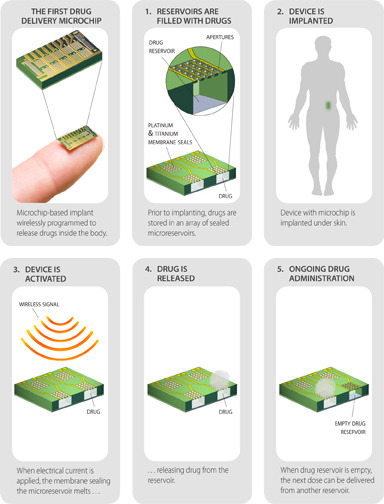 First wirelessly controlled drug-delivery chip successfully tested | KurzweilAI
Researchers from MIT and MicroCHIPS Inc. have developed and tested a programmable, wirelessly controlled chip to administer daily doses of an osteoporosis drug normally...