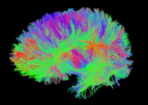 lasben: These are really beautiful… The process of diffusion direction imaging is a quite stu