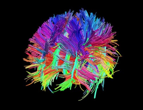 lasben: These are really beautiful… The process of diffusion direction imaging is a quite stu