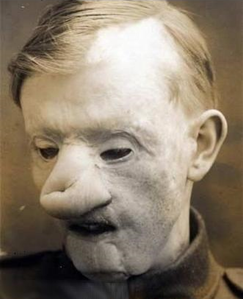  Early plastic surgery procedures.  