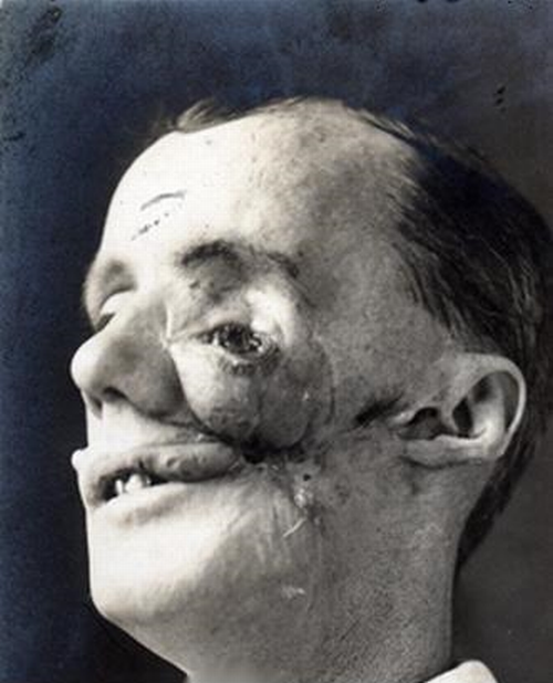  Early plastic surgery procedures.  