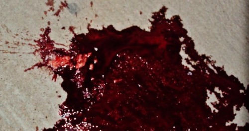 blasphemousfuck:  Shot in the back of the head, possibly drug related. 